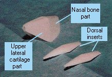 Photo of the original version of the Medpor Nasal Shell with inserts Photo of the original version of the Medpor Nasal Shell with inserts